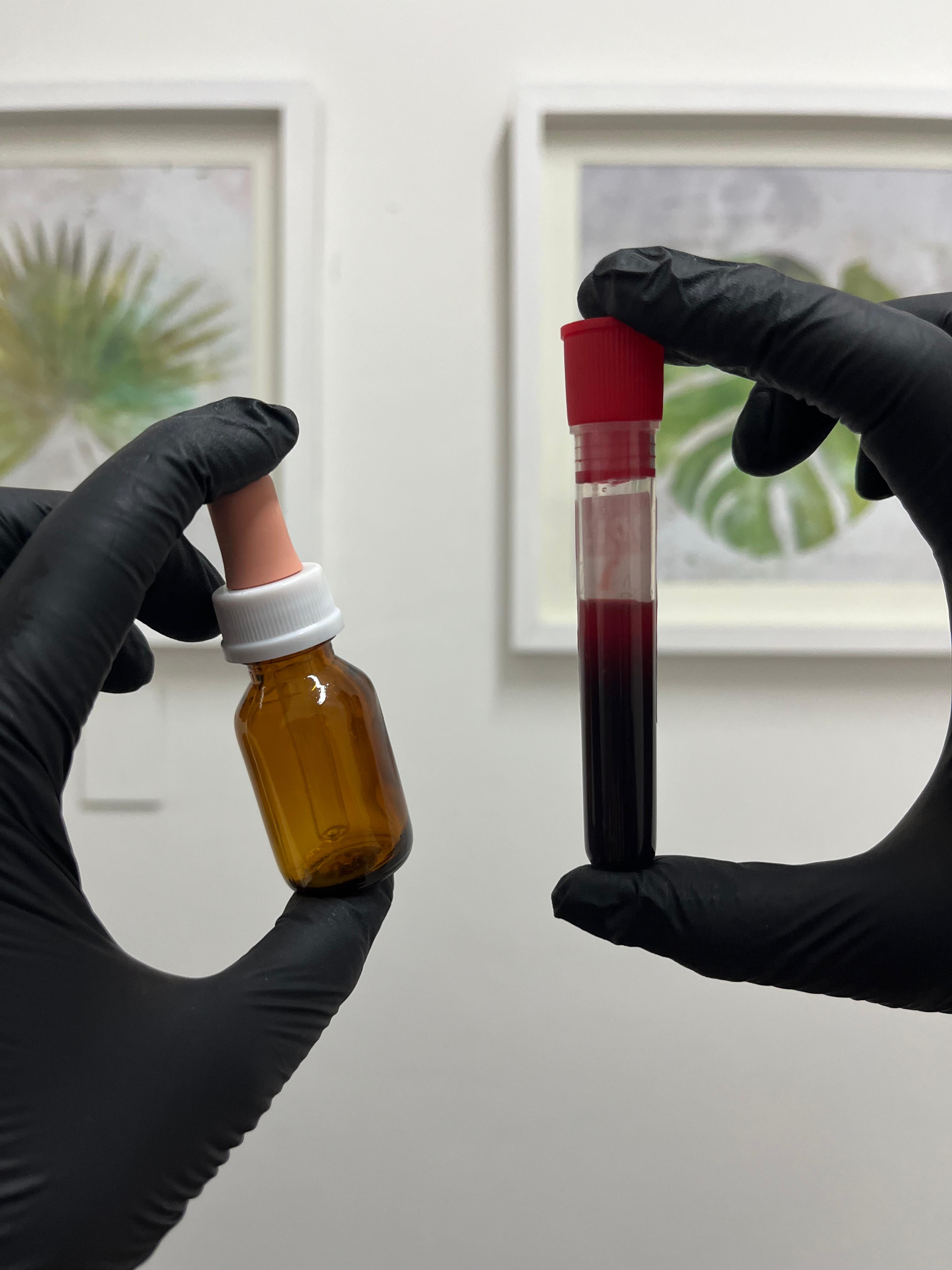 Tratamiento de suero autólogo